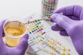 Purchase Phentermine Topiramate Online